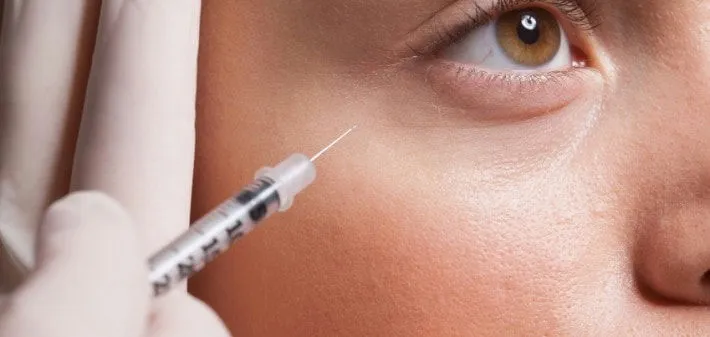 Revitaliza tu Rostro: Descubre el Poder del Botox en el Evento ANM Estética