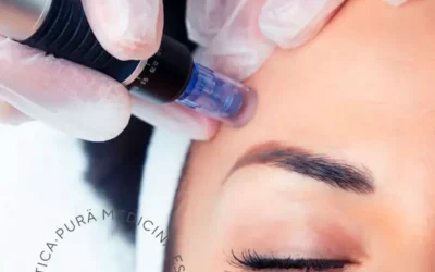 Descubre las Innovaciones con Dermapen Facial en el Evento ANM Estética